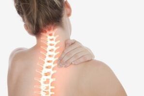 گردن درد همراه با پوکی استخوان