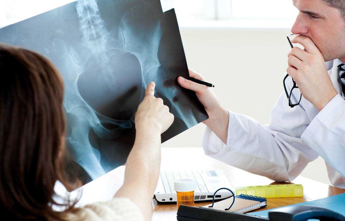 پزشکان در حال بررسی اشعه ایکس برای آرتروز مفصل ران